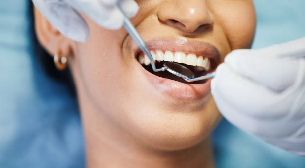 Best Knocked-Out Tooth (Avulsed Tooth) Treatment in Malmstrom Af, MT